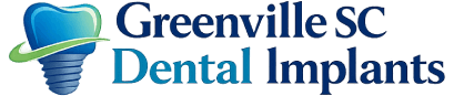 Greenville, SC Dental Implants Provider Guide